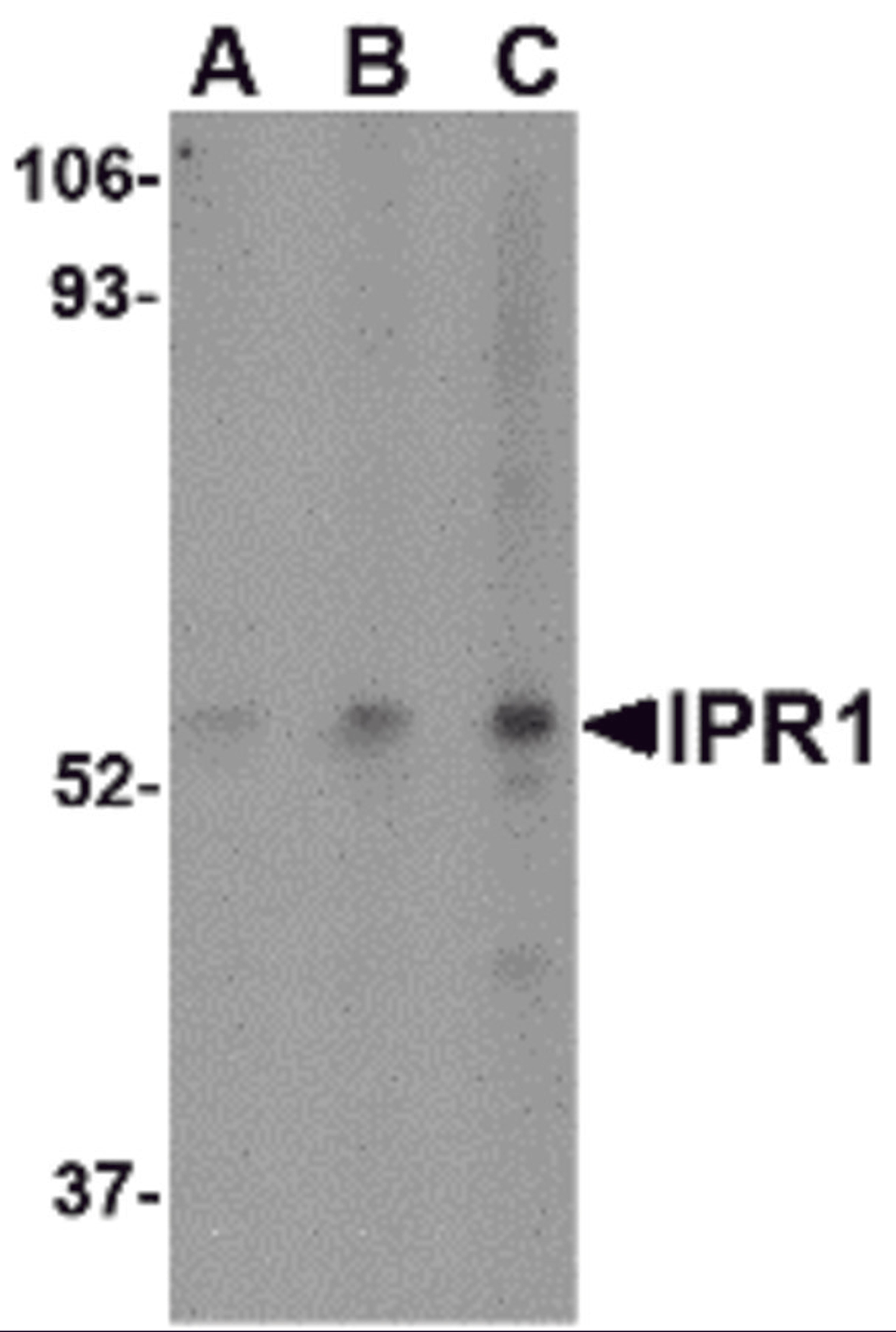 Western blot analysis of IPR1 in Hela cell lysate with IPR1 antibody at (A) 0.5, (B) 1, and (C) 2 μg/mL.