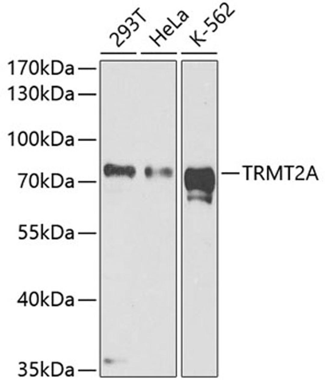 Western blot - TRMT2A antibody (A5975)