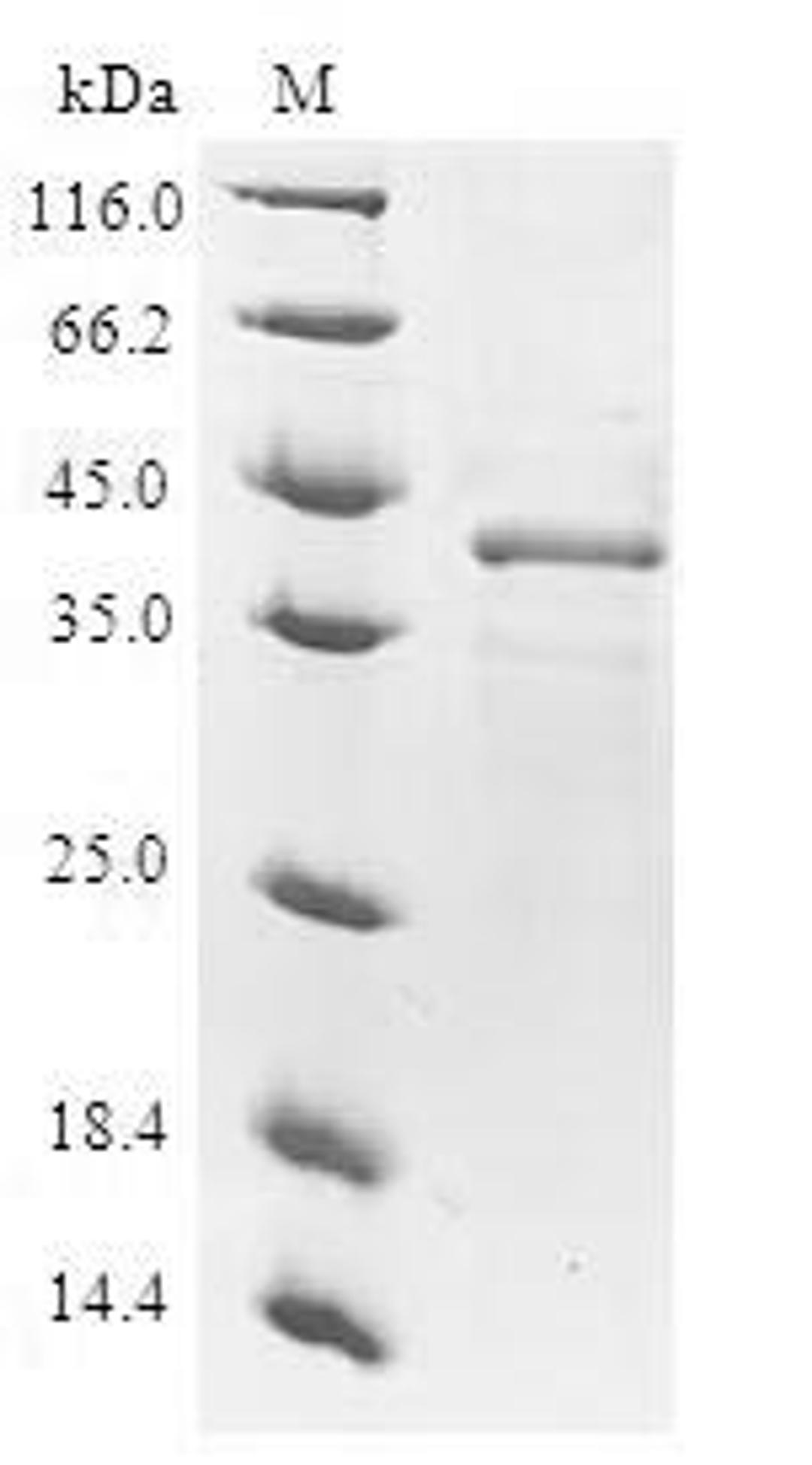 (Tris-Glycine gel) Discontinuous SDS-PAGE (reduced) with 5% enrichment gel and 15% separation gel.