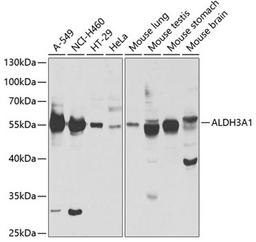 Western blot - ALDH3A1 antibody (A5502)