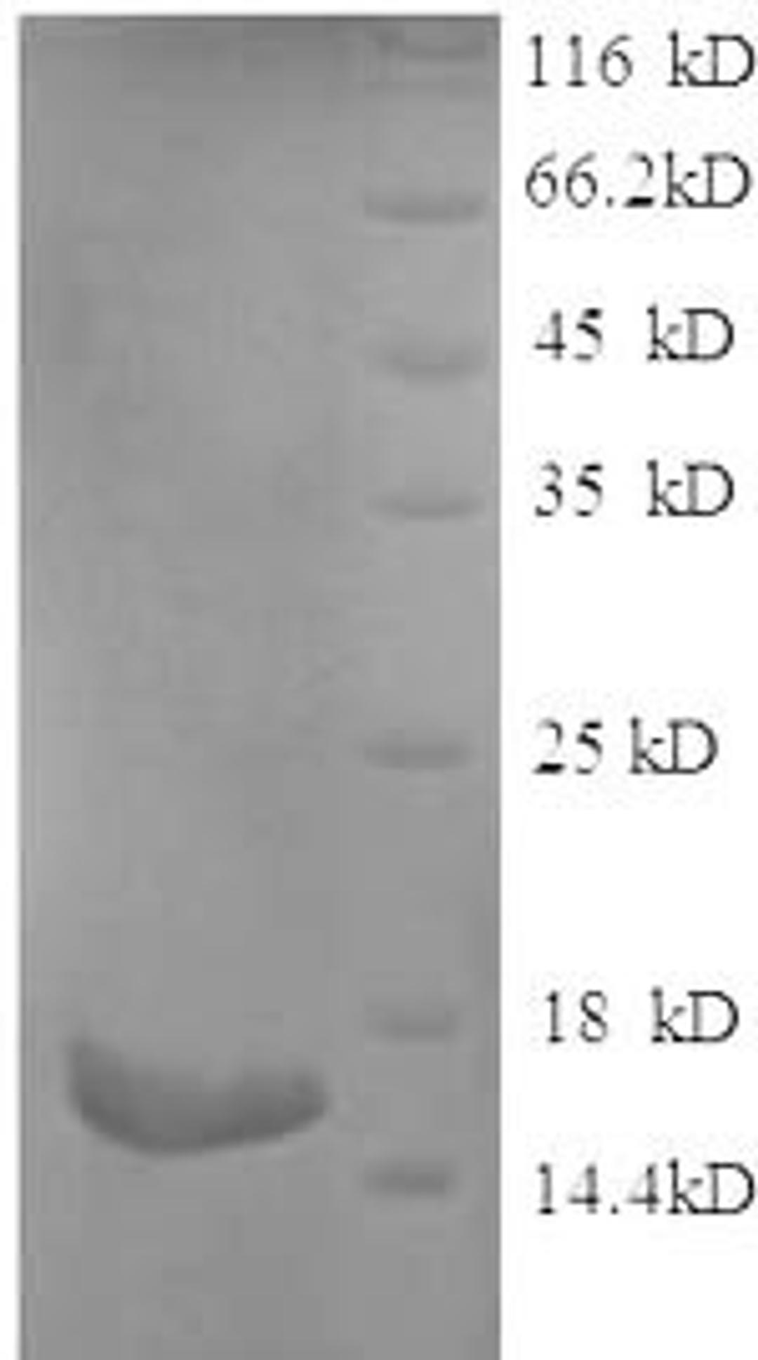 (Tris-Glycine gel) Discontinuous SDS-PAGE (reduced) with 5% enrichment gel and 15% separation gel.