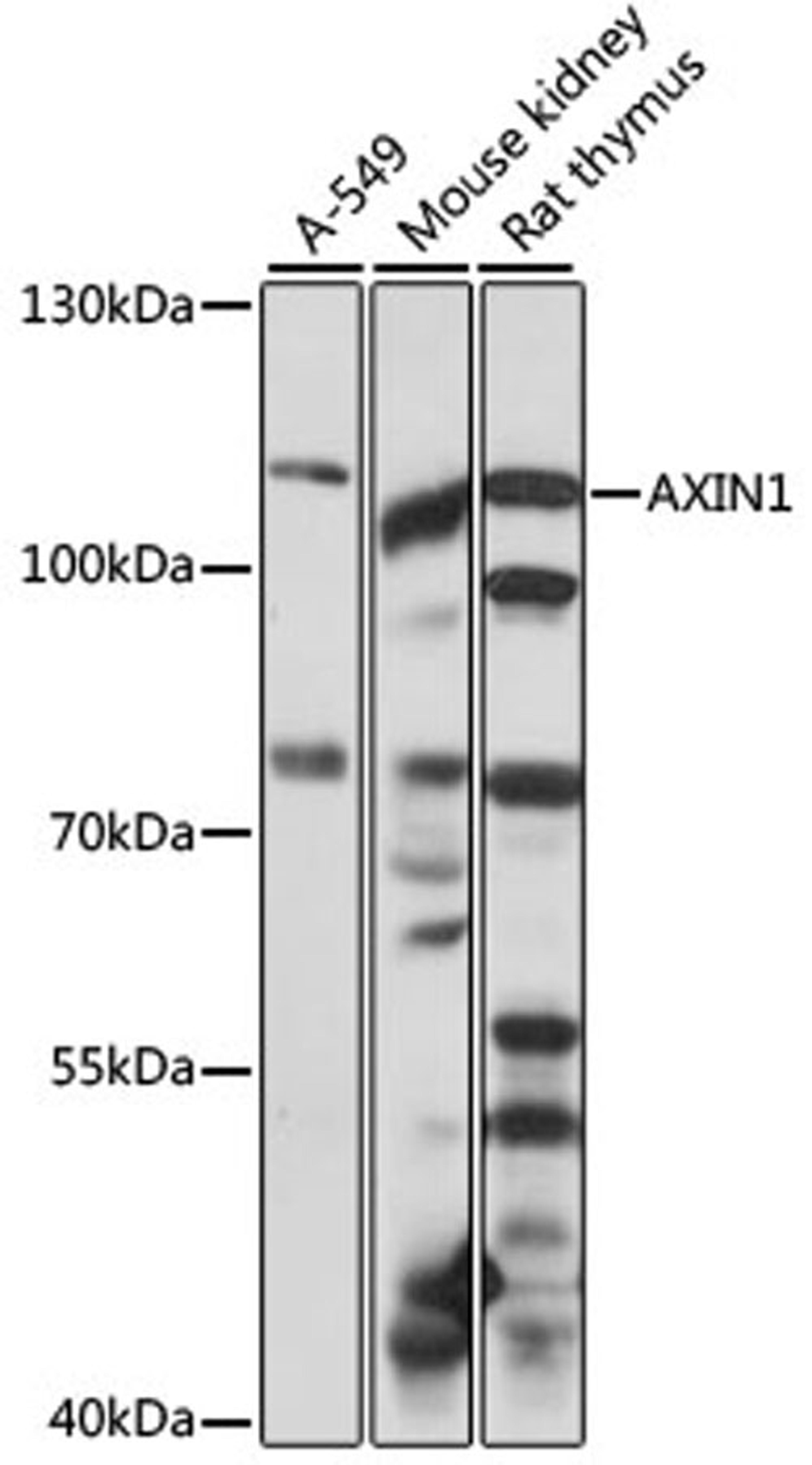 Western blot - AXIN1 antibody (A16019)