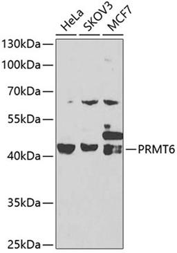 Western blot - PRMT6 antibody (A7814)