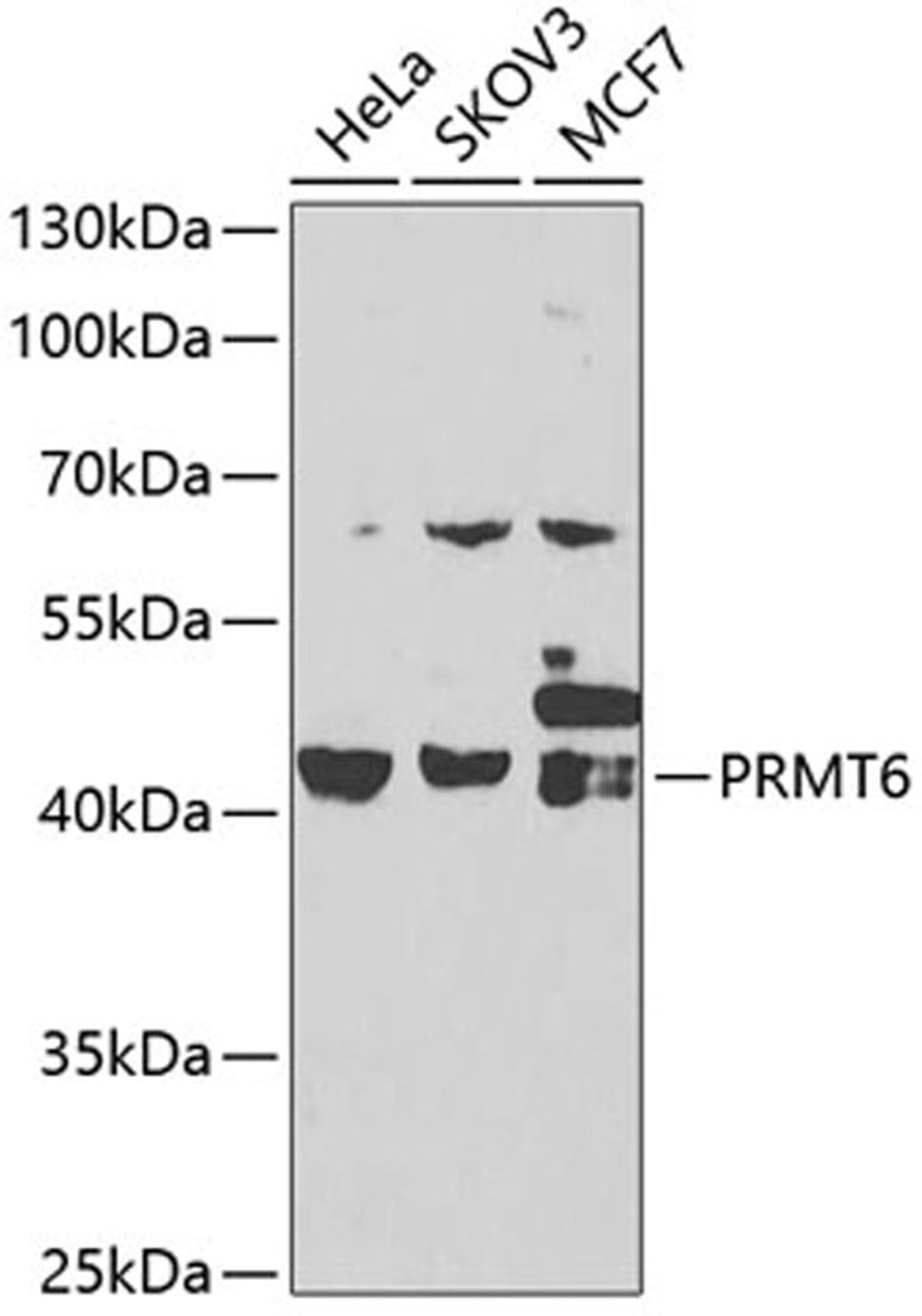 Western blot - PRMT6 antibody (A7814)