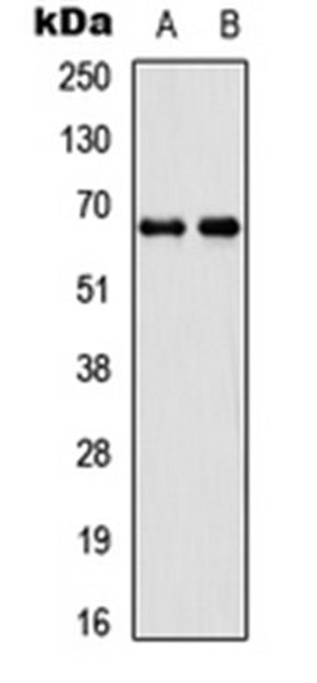 Western blot analysis of SHSY5Y (Lane 1), 293T (Lane 2) whole cell lysates using DDX55 antibody