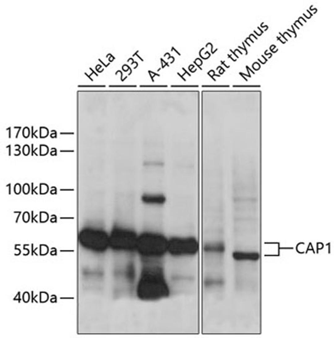 Western blot - CAP1 antibody (A14577)