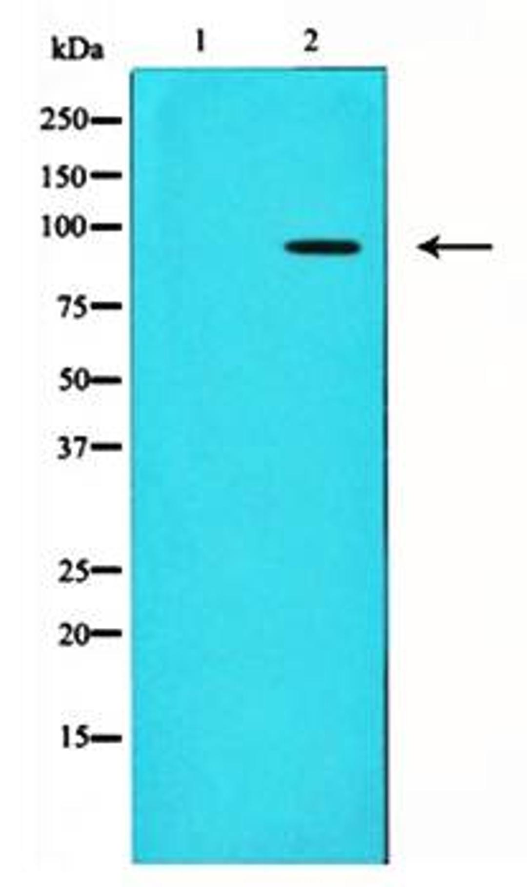 Western blot analysis of HT1080 whole cell lysate using ADAM 17 antibody