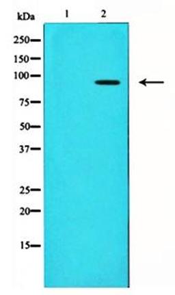 Western blot analysis of HT1080 whole cell lysate using ADAM 17 antibody