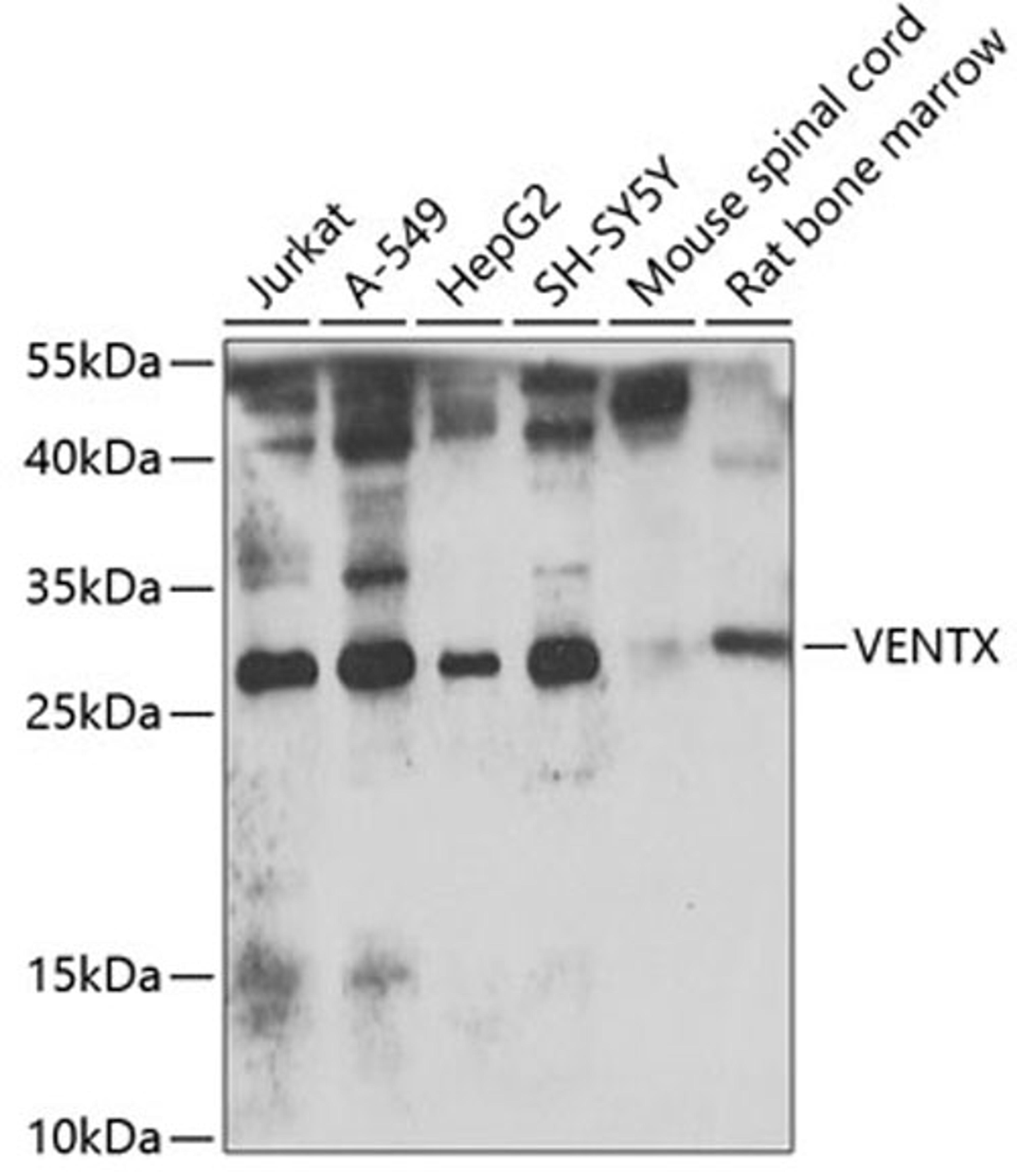 Western blot - VENTX antibody (A7467)