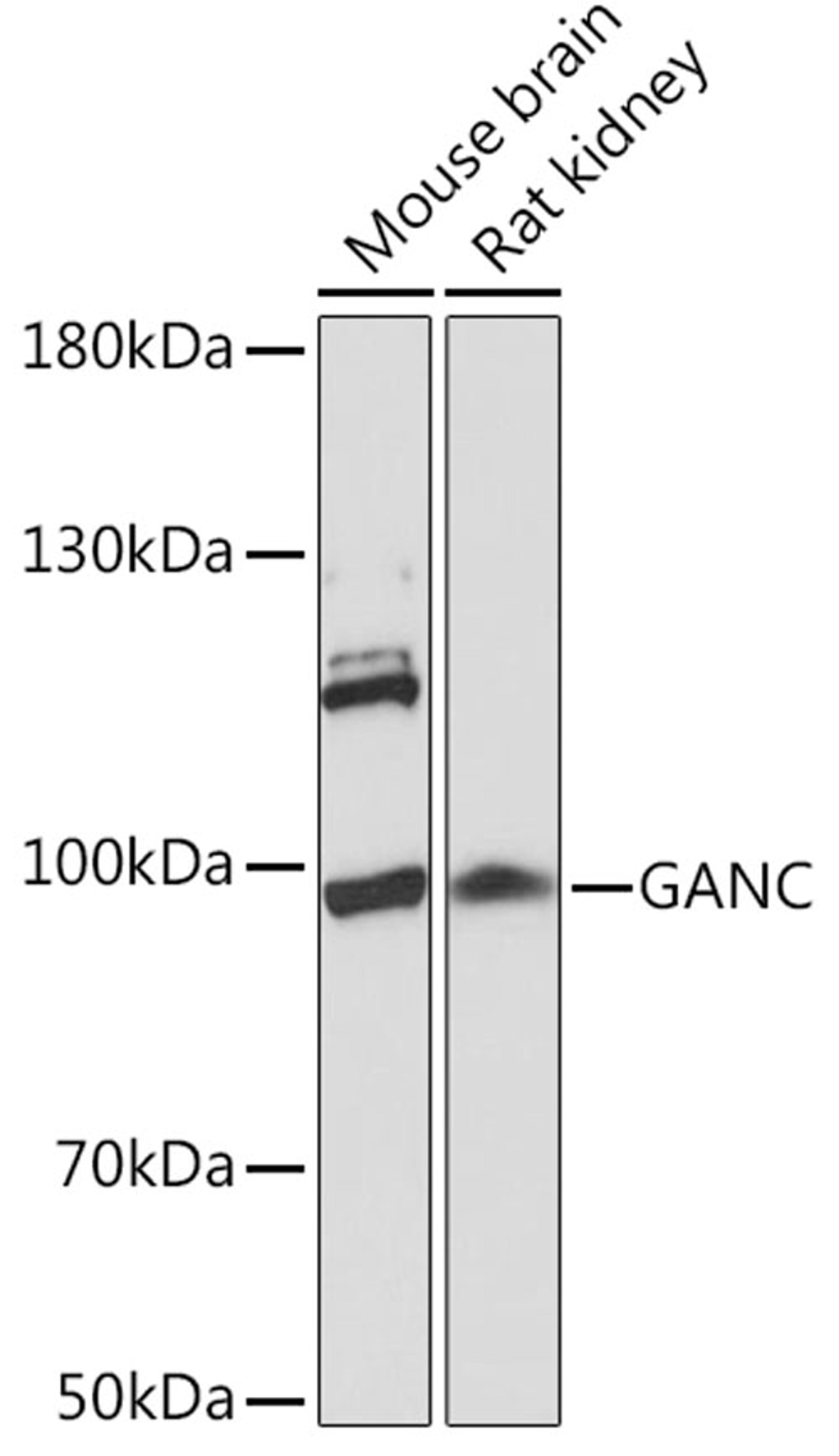 Western blot - GANC Rabbit pAb (A16377)