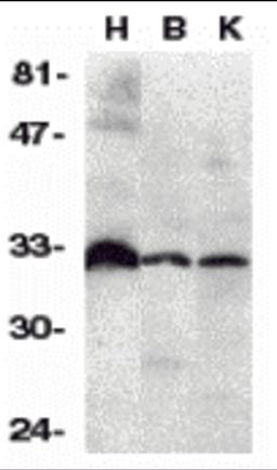 Western blot analysis of DcR3 in human heart (H), brain (B), and kidney (K) tissue lysates with DcR3 antibody at 1:500 dilution. 