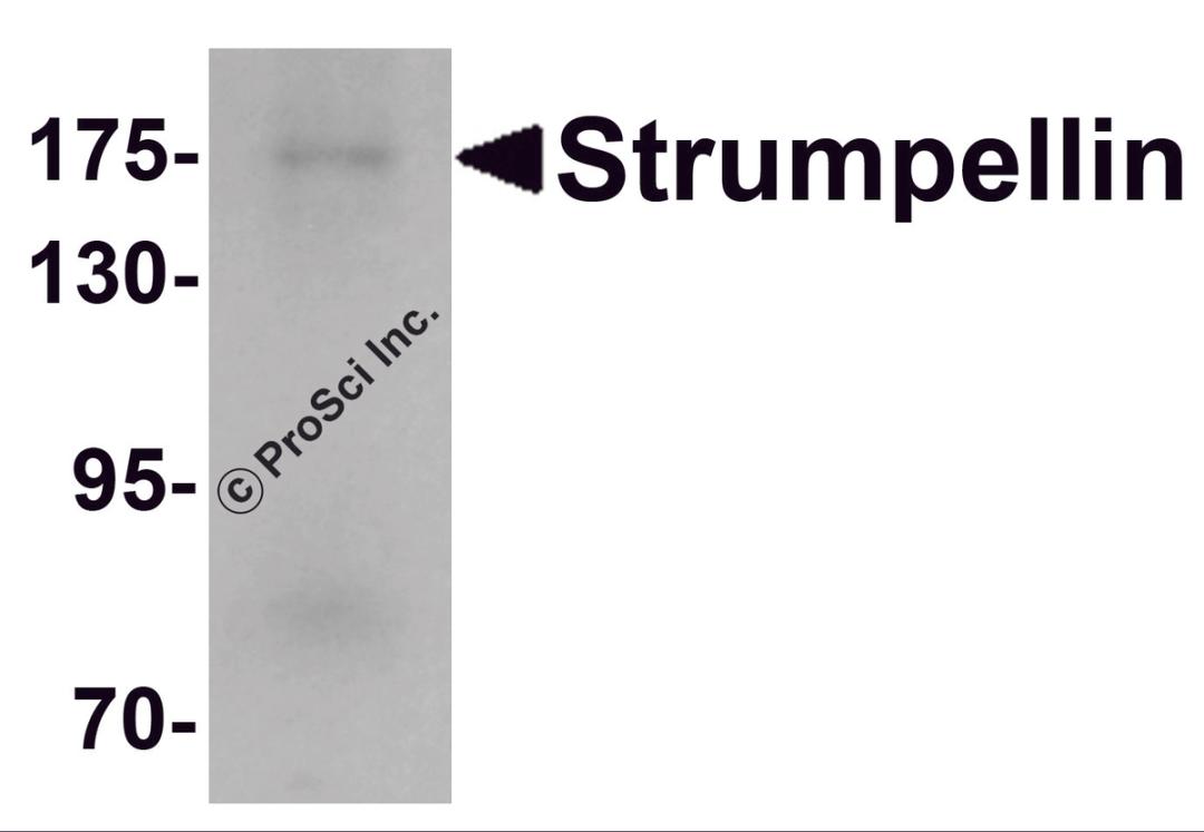 Western blot analysis of Strumpellin in human ovary tissue lysate with Strumpellin antibody at 1 &#956;g/mL.