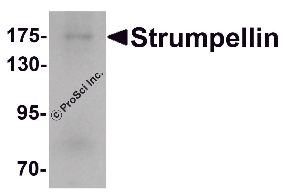 Western blot analysis of Strumpellin in human ovary tissue lysate with Strumpellin antibody at 1 μg/mL.
