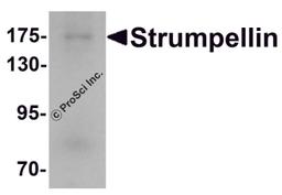Western blot analysis of Strumpellin in human ovary tissue lysate with Strumpellin antibody at 1 μg/mL.
