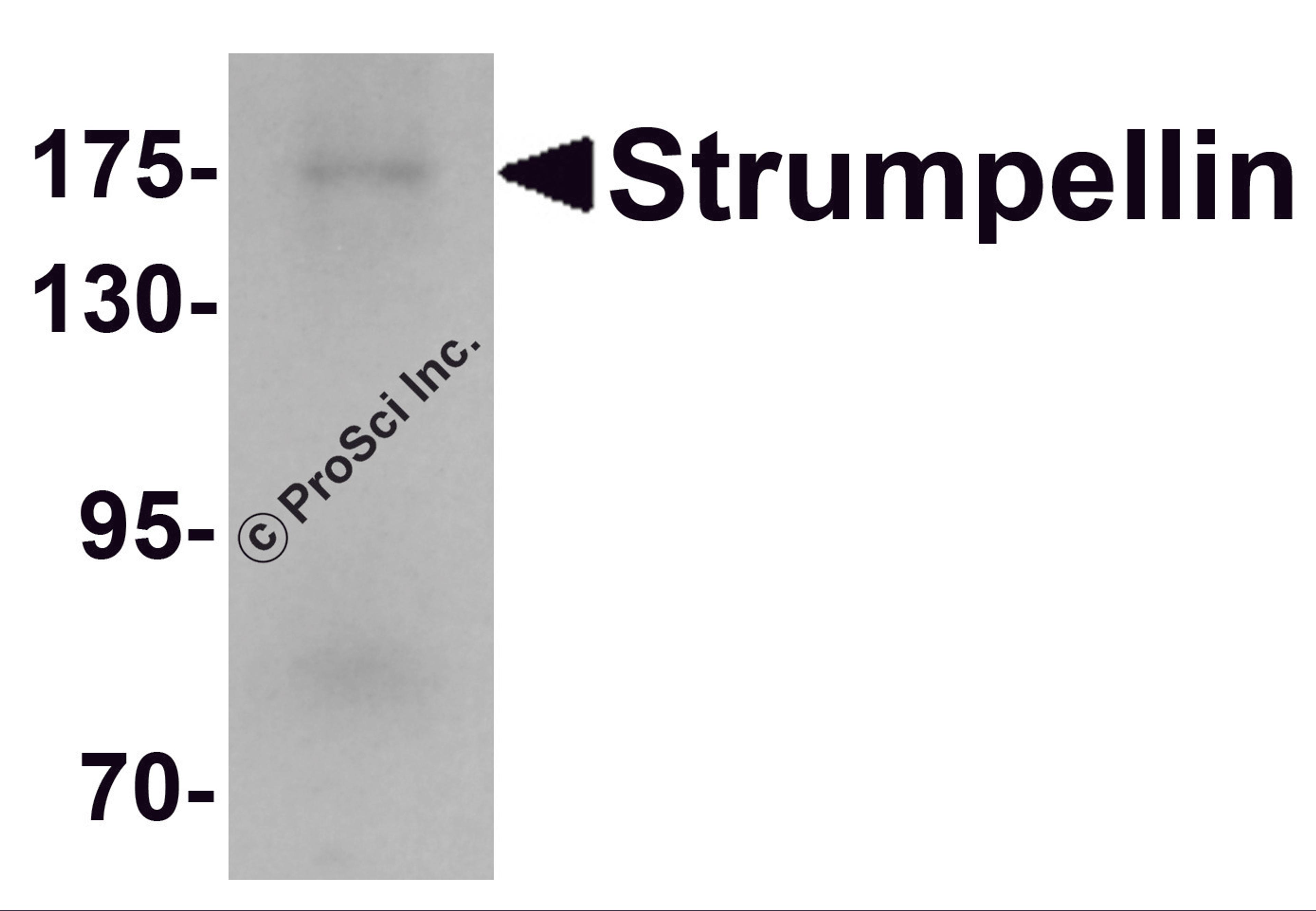 Western blot analysis of Strumpellin in human ovary tissue lysate with Strumpellin antibody at 1 μg/mL.