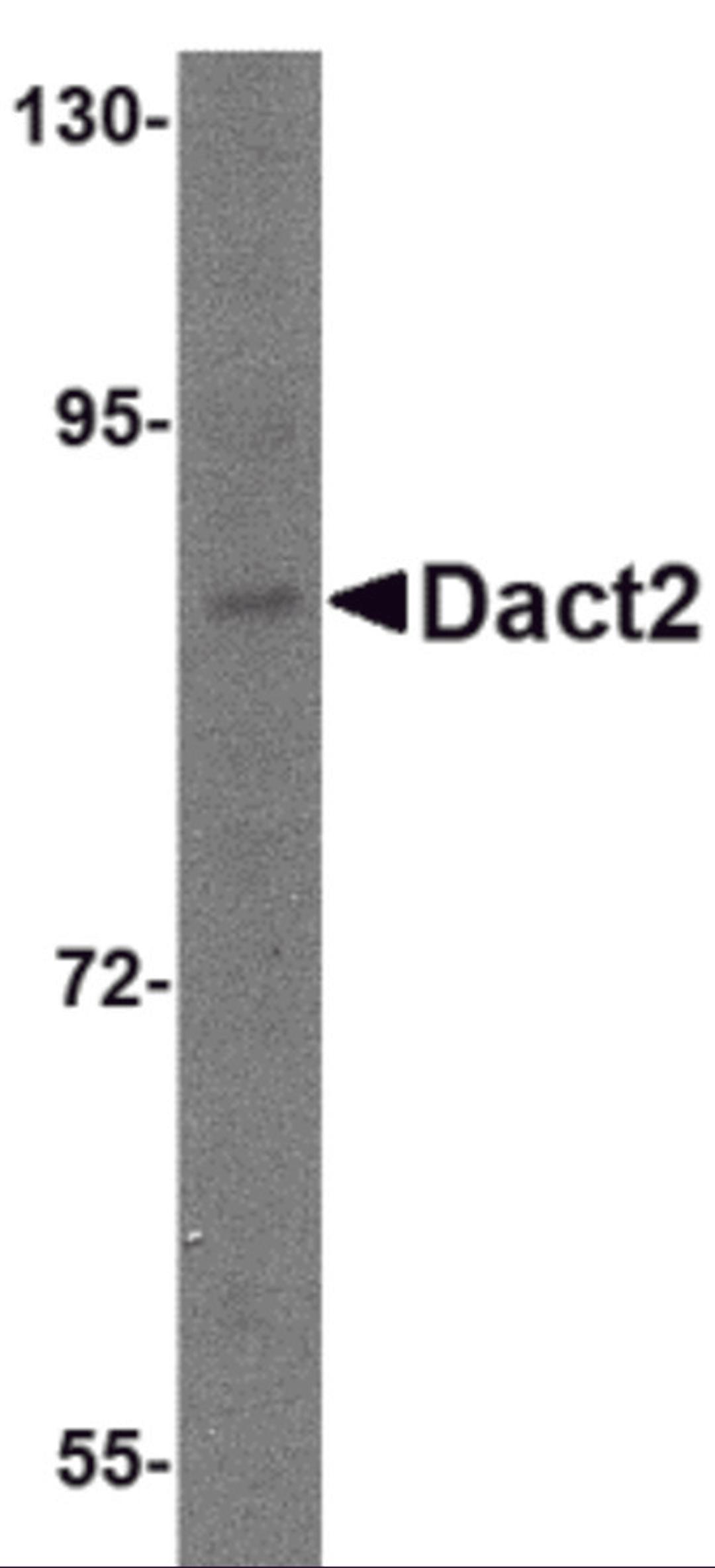 Western blot analysis of Dact2 in SK-N-SH cell lysate with Dact2 antibody at 1 μg/mL.