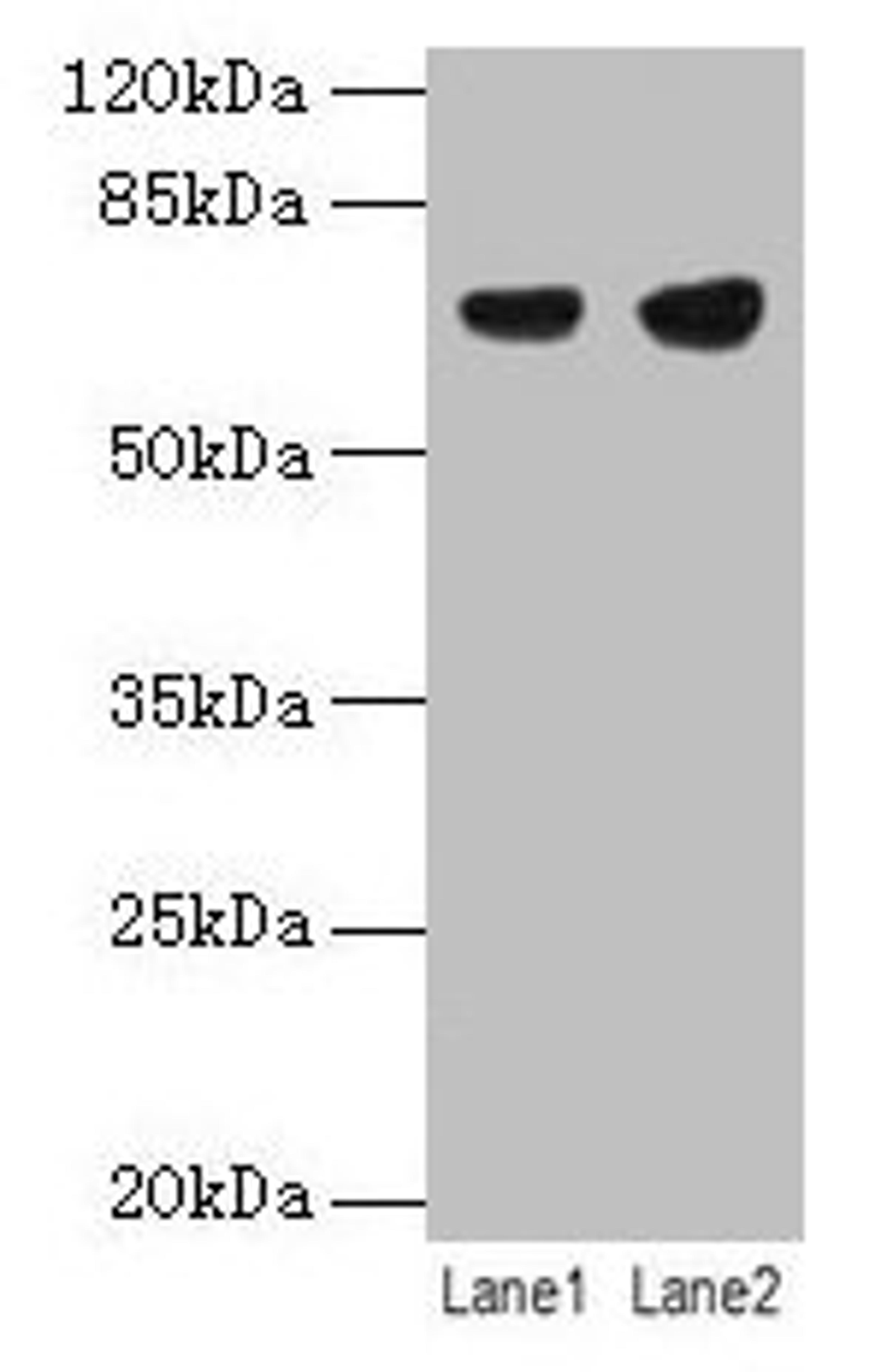 Western blot. All lanes: PTPN6 antibody at 12µg/ml. Lane 1: Jurkat whole cell lysate. Lane 2: Raji whole cell lysate. Secondary. Goat polyclonal to rabbit IgG at 1/10000 dilution. Predicted band size: 68, 64, 71 kDa. Observed band size: 68 kDa