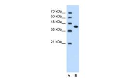 Antibody used in WB on Human Jurkat 1.25 ug/ml.