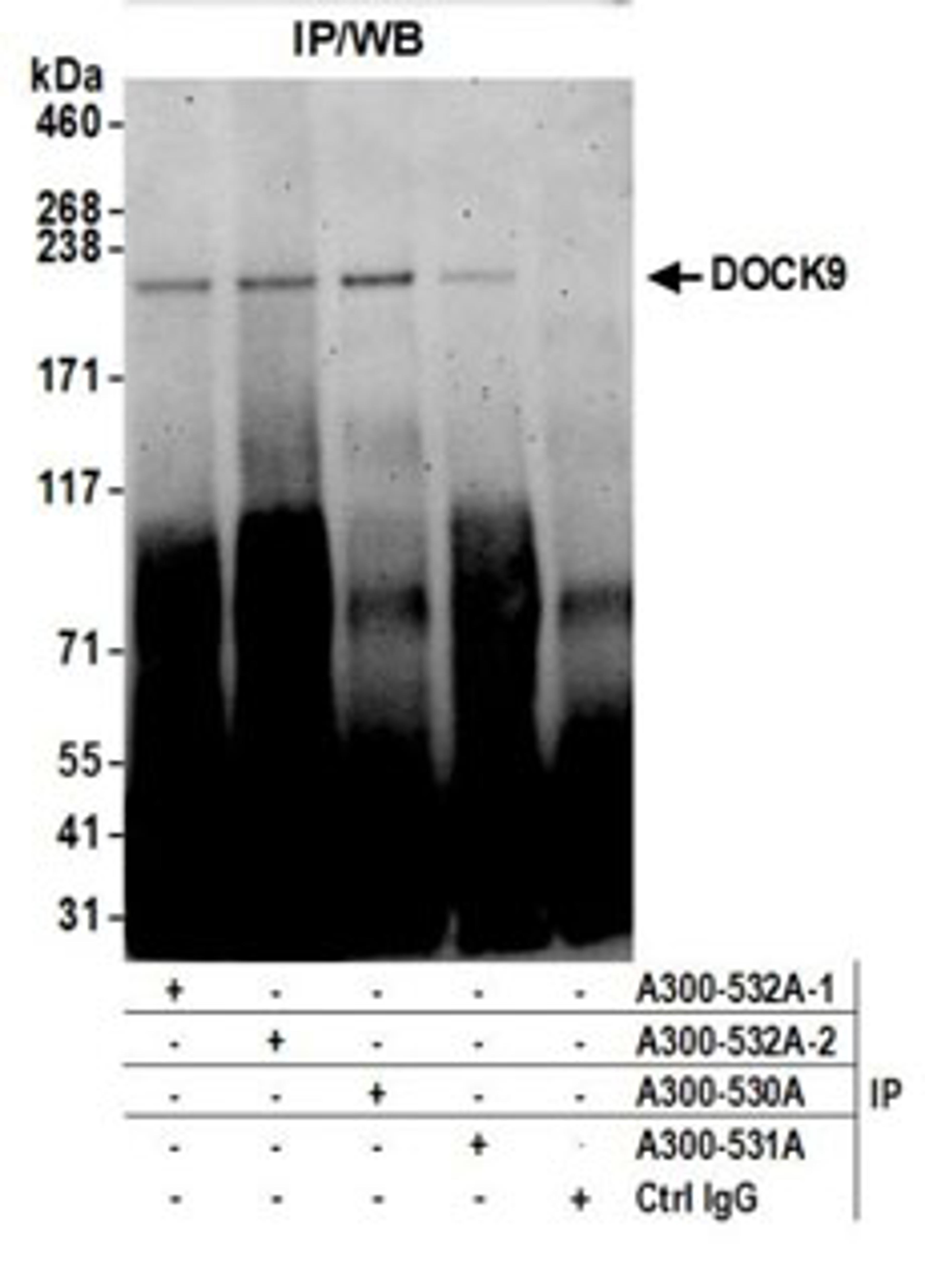 Detection of human DOCK9 by western blot of immunoprecipitates.