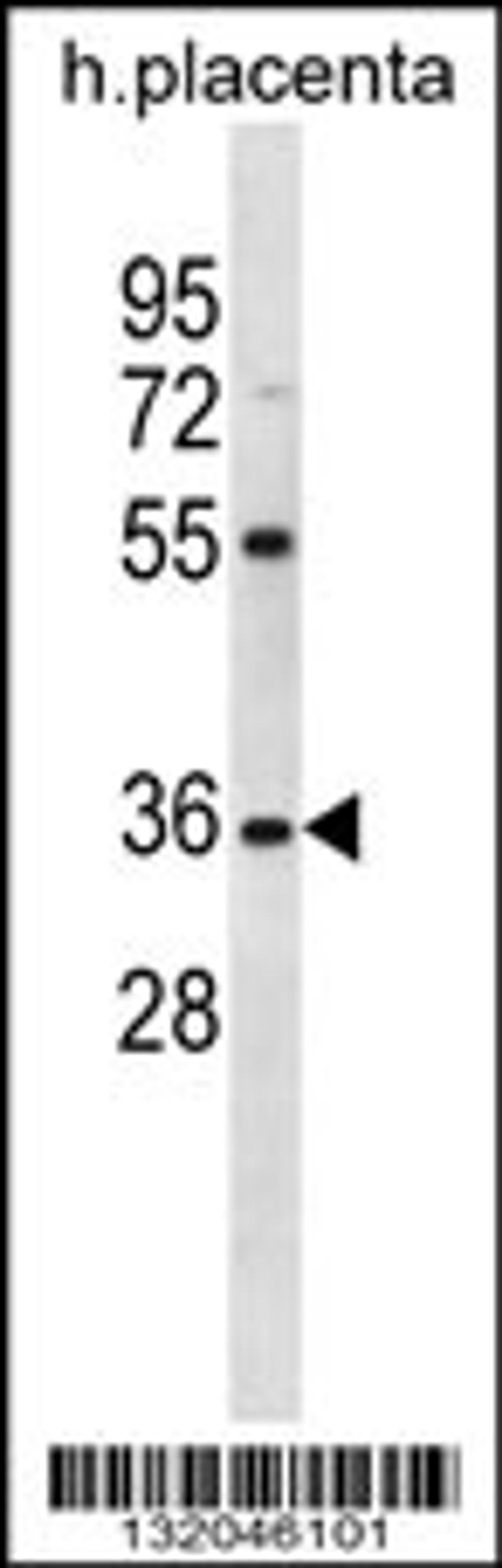 Western blot analysis in human placenta tissue lysates (35ug/lane).