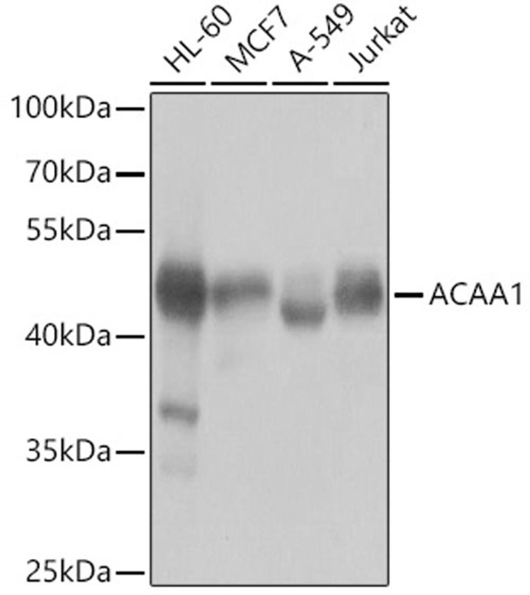 Western blot - ACAA1 antibody (A7422)