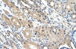 Immunohistochemistry-Paraffin: GEM Antibody [NBP1-58906] - Human kidney Tissue, antibody concentration 4-8ug/ml. Cells with positive label: renal corpuscle cells (indicated with arrows) 400X magnification.