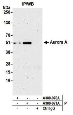 Detection of human Aurora A by western blot of immunoprecipitates.