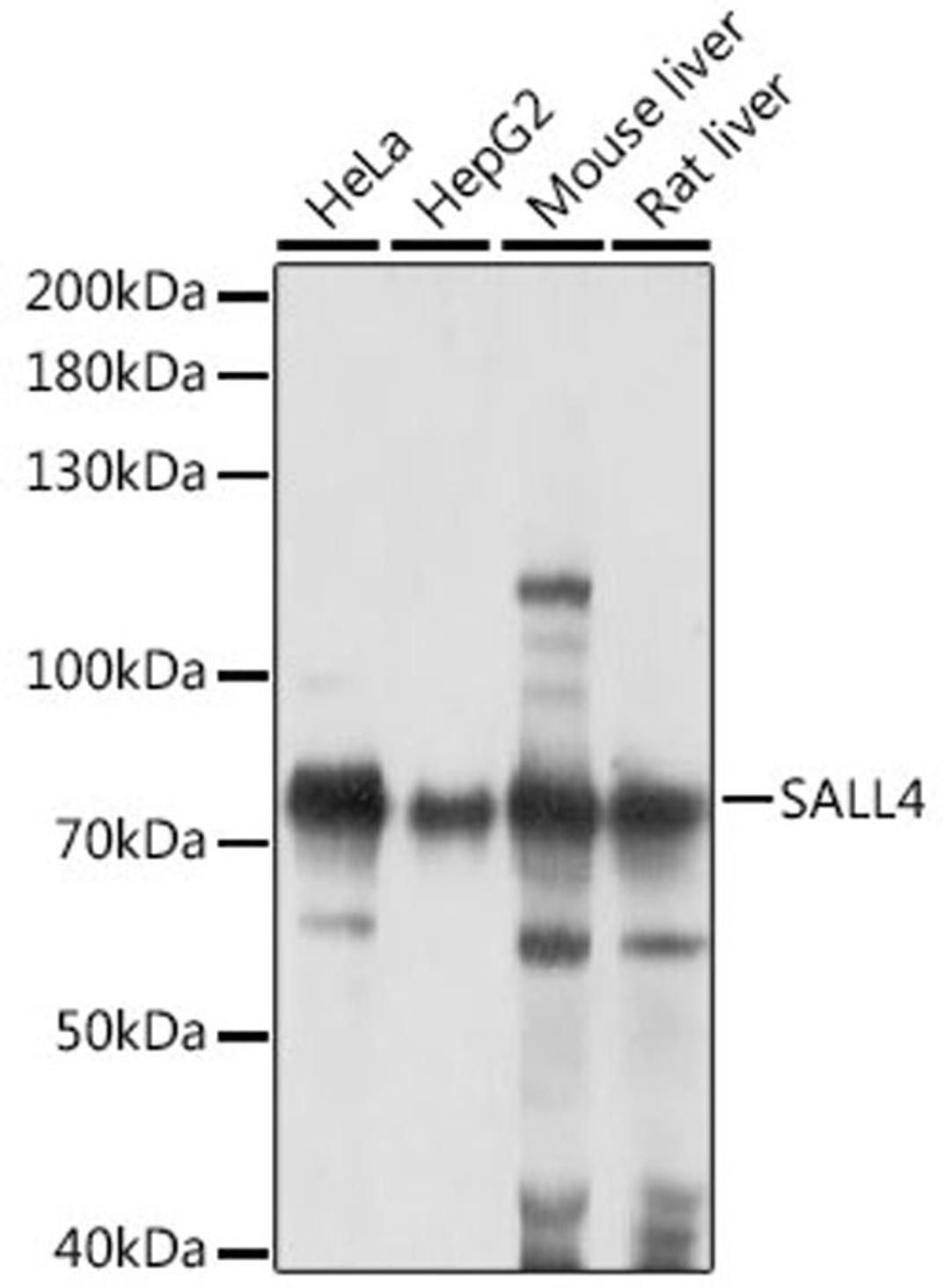 Western blot - SALL4 antibody (A16193)