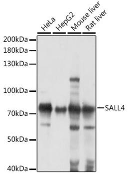 Western blot - SALL4 antibody (A16193)