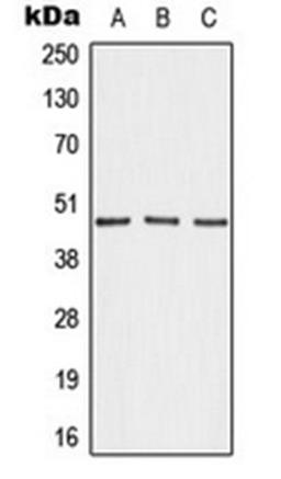 Western blot analysis of MDAMB231 (Lane 1), NIH3T3 (Lane 2), H9C2 (Lane 3) whole cell lysates using AKAP5 antibody