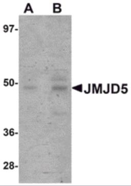 Western blot analysis of JMJD5 in human liver tissue lysate with JMJD5 antibody at (A) 1 and (B) 2 &#956;g/mL.