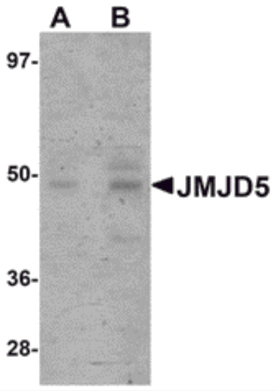 Western blot analysis of JMJD5 in human liver tissue lysate with JMJD5 antibody at (A) 1 and (B) 2 μg/mL.