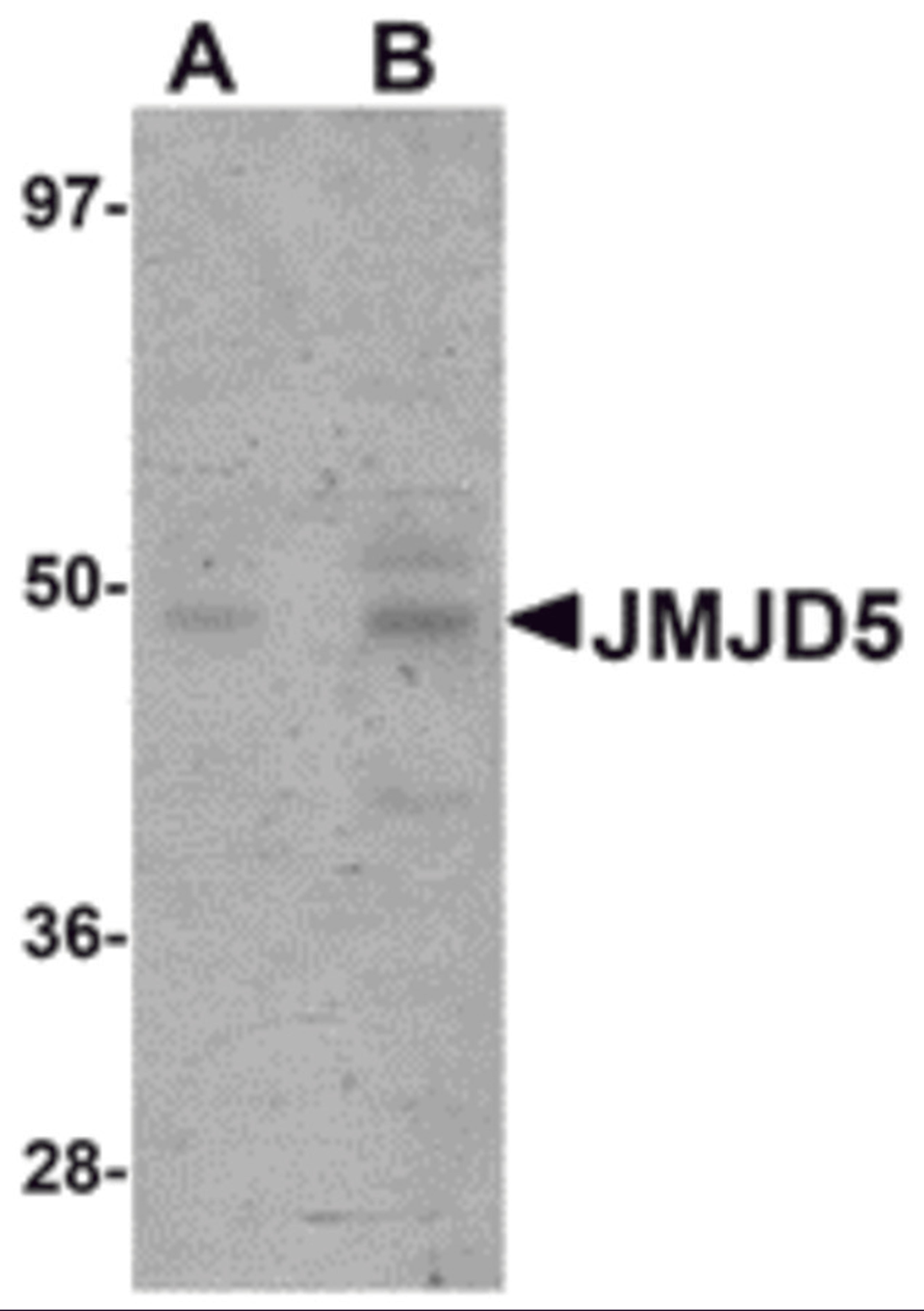Western blot analysis of JMJD5 in human liver tissue lysate with JMJD5 antibody at (A) 1 and (B) 2 μg/mL.