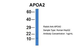 Western Blot: Apolipoprotein A-II/ApoA2 Antibody [NBP1-57716] - Human HepG2, Antibody Dilution: 1.0 ug/ml APOA2 is strongly supported by BioGPS gene expression data to be expressed in Human HepG2 cells.