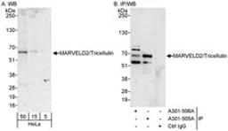 Detection of human MARVELD2/Tricellulin by western blot and immunoprecipitation.