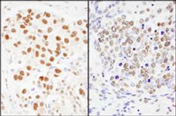 Detection of human and mouse SF3a120/SAP114 by immunohistochemistry.