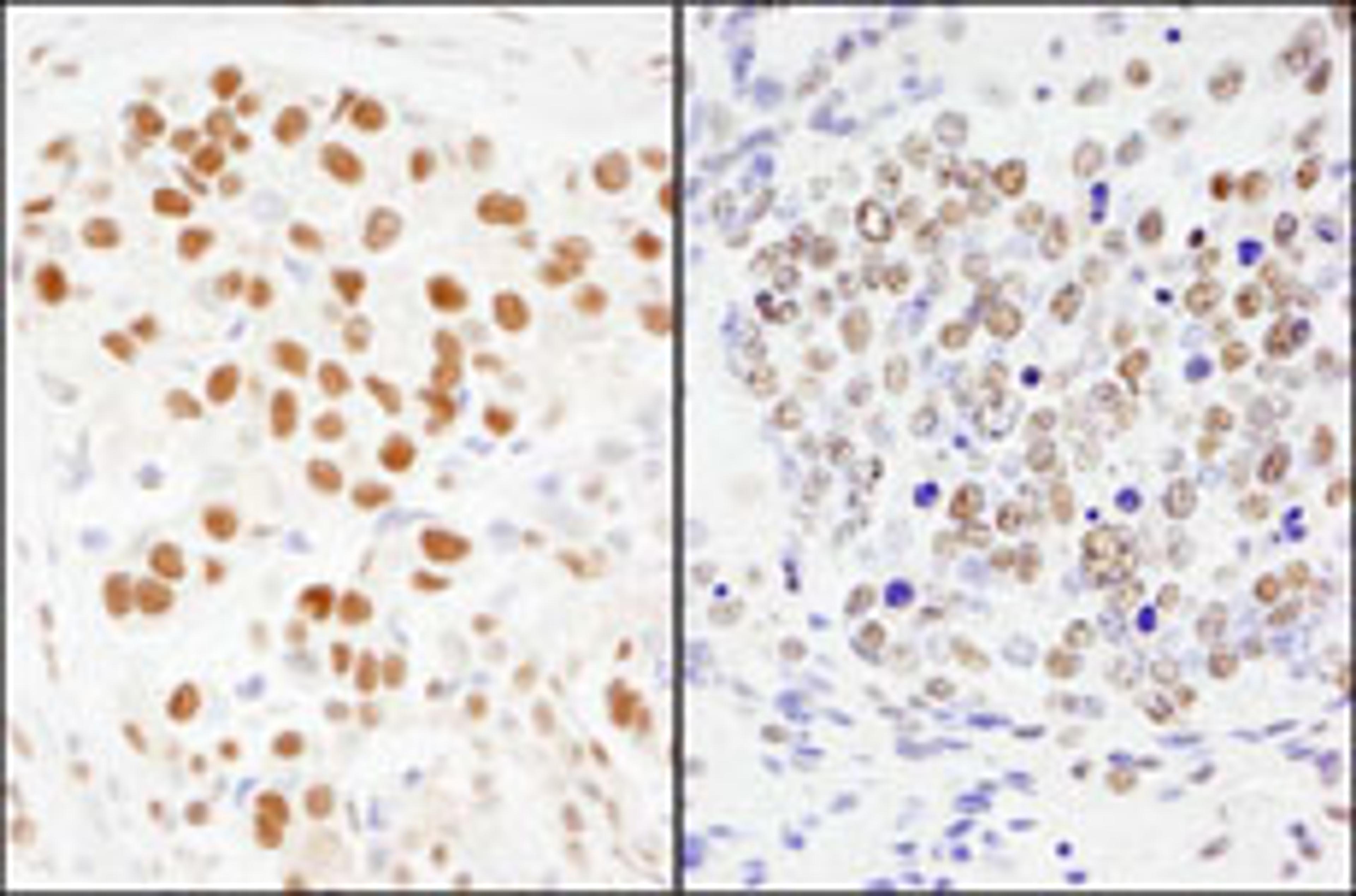 Detection of human and mouse SF3a120/SAP114 by immunohistochemistry.