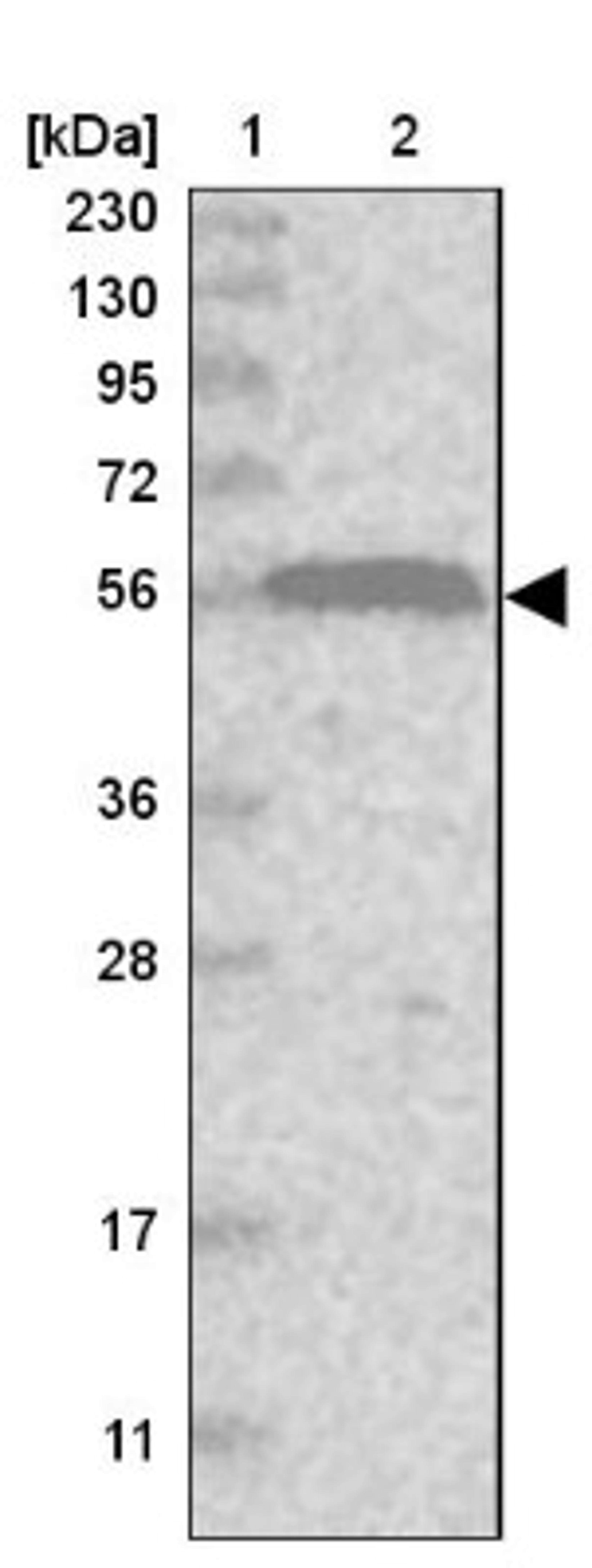 Western Blot: RIN2 Antibody [NBP1-80854] - Lane 1: Marker [kDa] 230, 130, 95, 72, 56, 36, 28, 17, 11<br/>Lane 2: Human cell line RT-4