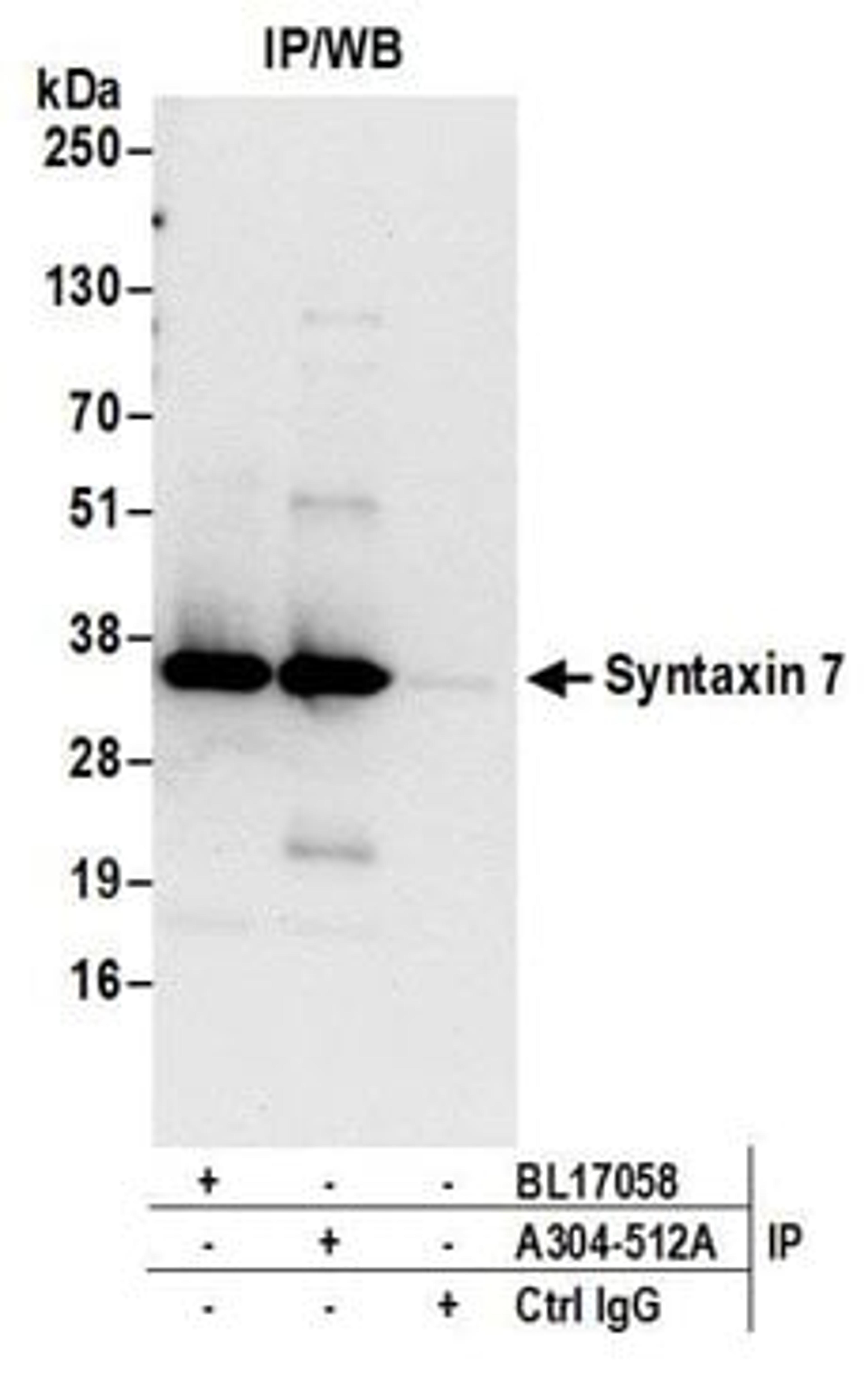 Detection of human Syntaxin 7 by western blot of immunoprecipitates.