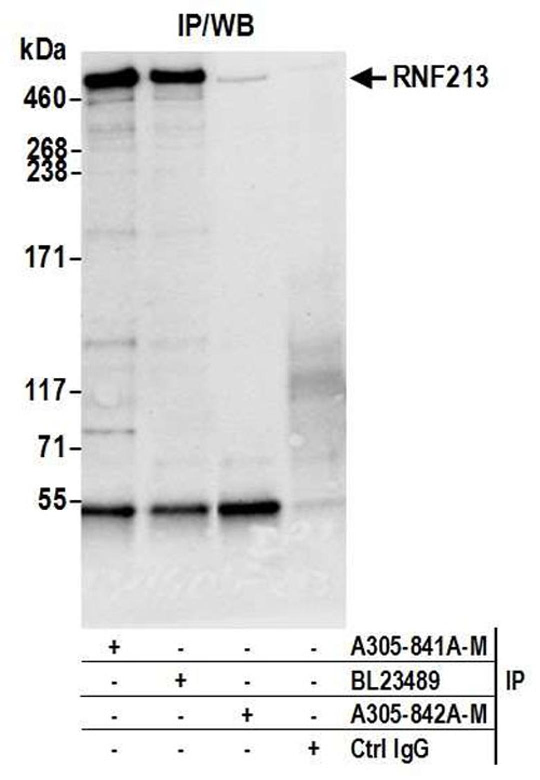 Detection of human RNF213 by WB of IP.