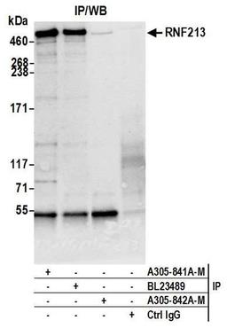 Detection of human RNF213 by WB of IP.