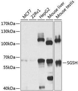 Western blot - SGSH antibody (A8148)