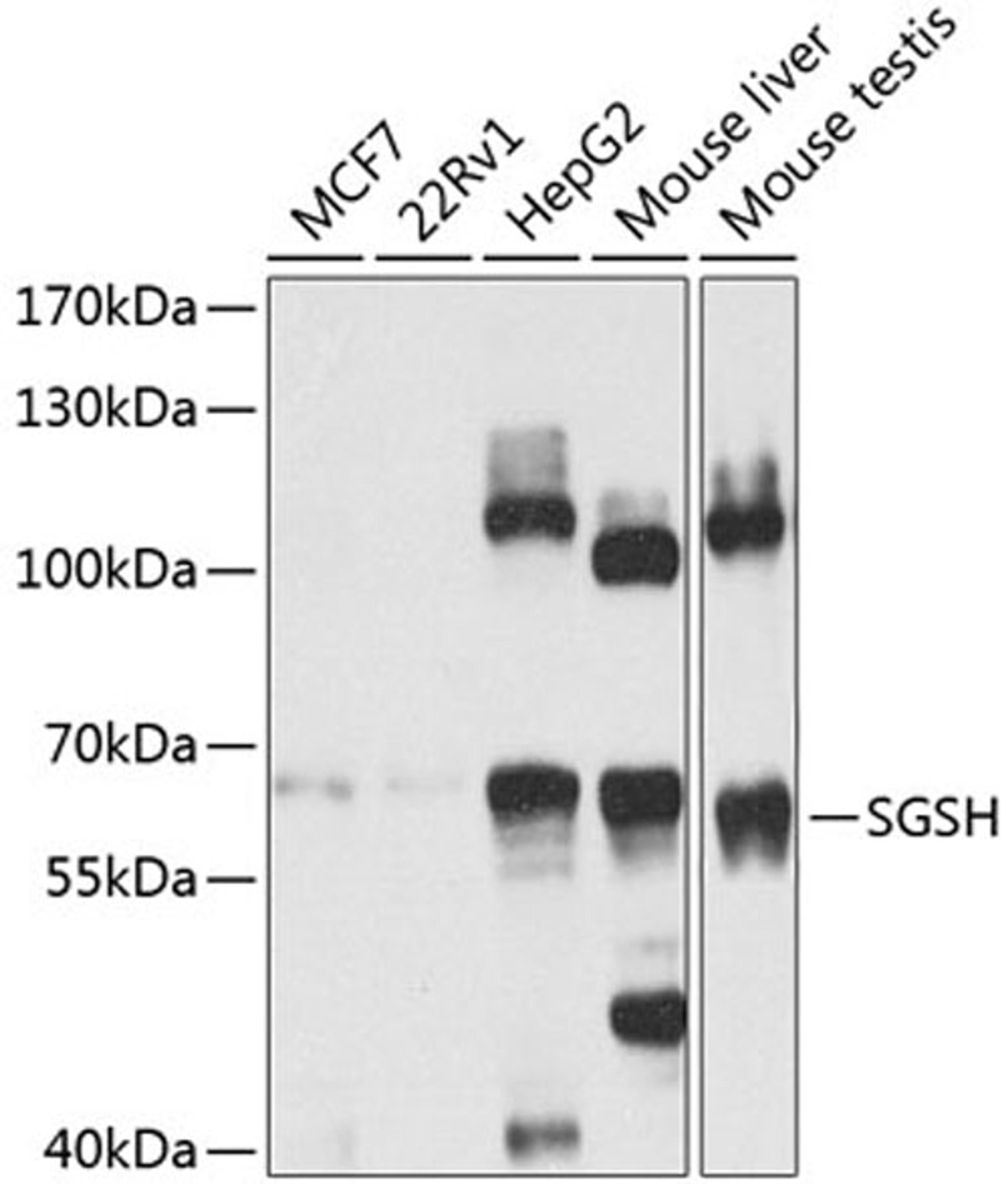 Western blot - SGSH antibody (A8148)