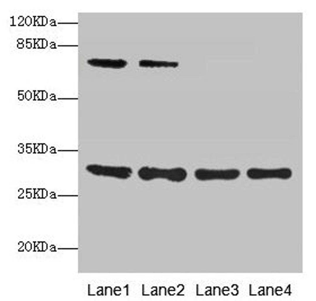 Western blot. All lanes: SPIN3 antibody at 6µg/ml. Lane 1: A549 whole cell lysate. Lane 2: Hela whole cell lysate. Lane 3: A431 whole cell lysate. Lane 4: HepG2 whole cell lysate. Secondary. Goat polyclonal to rabbit IgG at 1/10000 dilution. Predicted band size: 30, 9 kDa. Observed band size: 30, 70 kDa