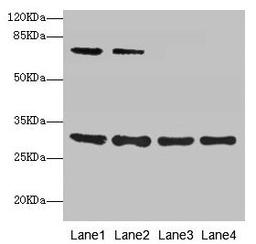 Western blot. All lanes: SPIN3 antibody at 6µg/ml. Lane 1: A549 whole cell lysate. Lane 2: Hela whole cell lysate. Lane 3: A431 whole cell lysate. Lane 4: HepG2 whole cell lysate. Secondary. Goat polyclonal to rabbit IgG at 1/10000 dilution. Predicted band size: 30, 9 kDa. Observed band size: 30, 70 kDa