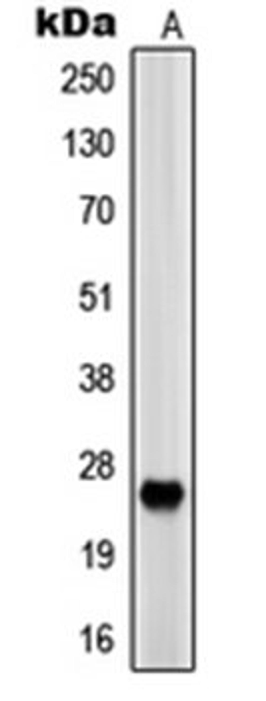 Western blot analysis of HEK293 (Lane 1) whole cell lysates using PRSS33 antibody