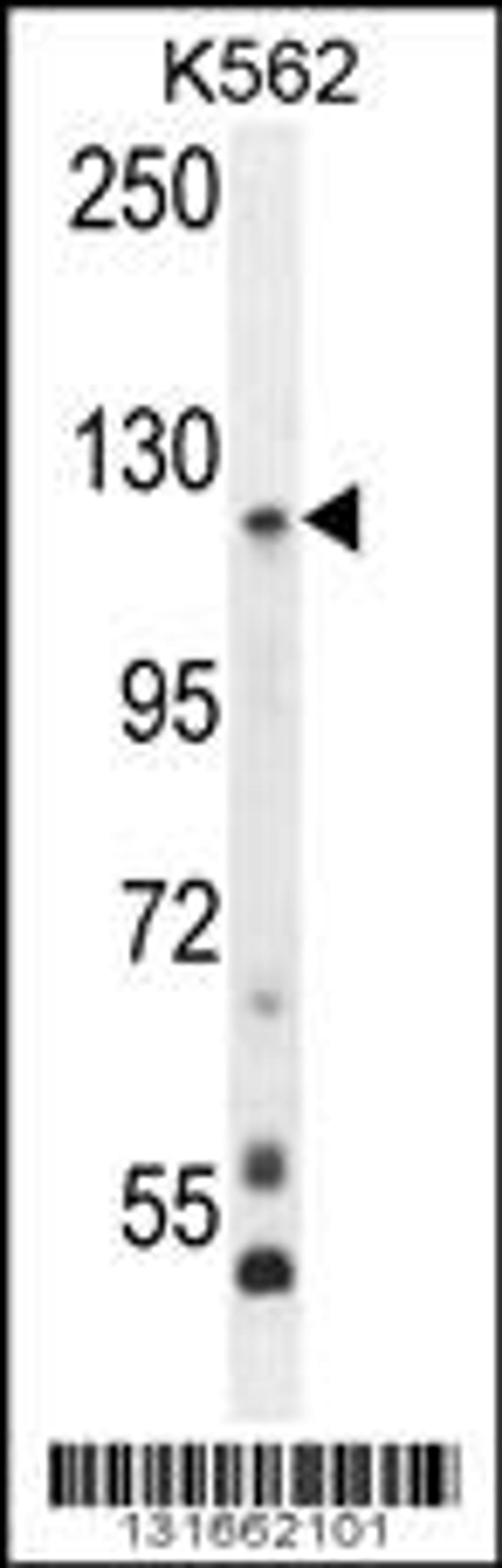 Western blot analysis in K562 cell line lysates (35ug/lane).