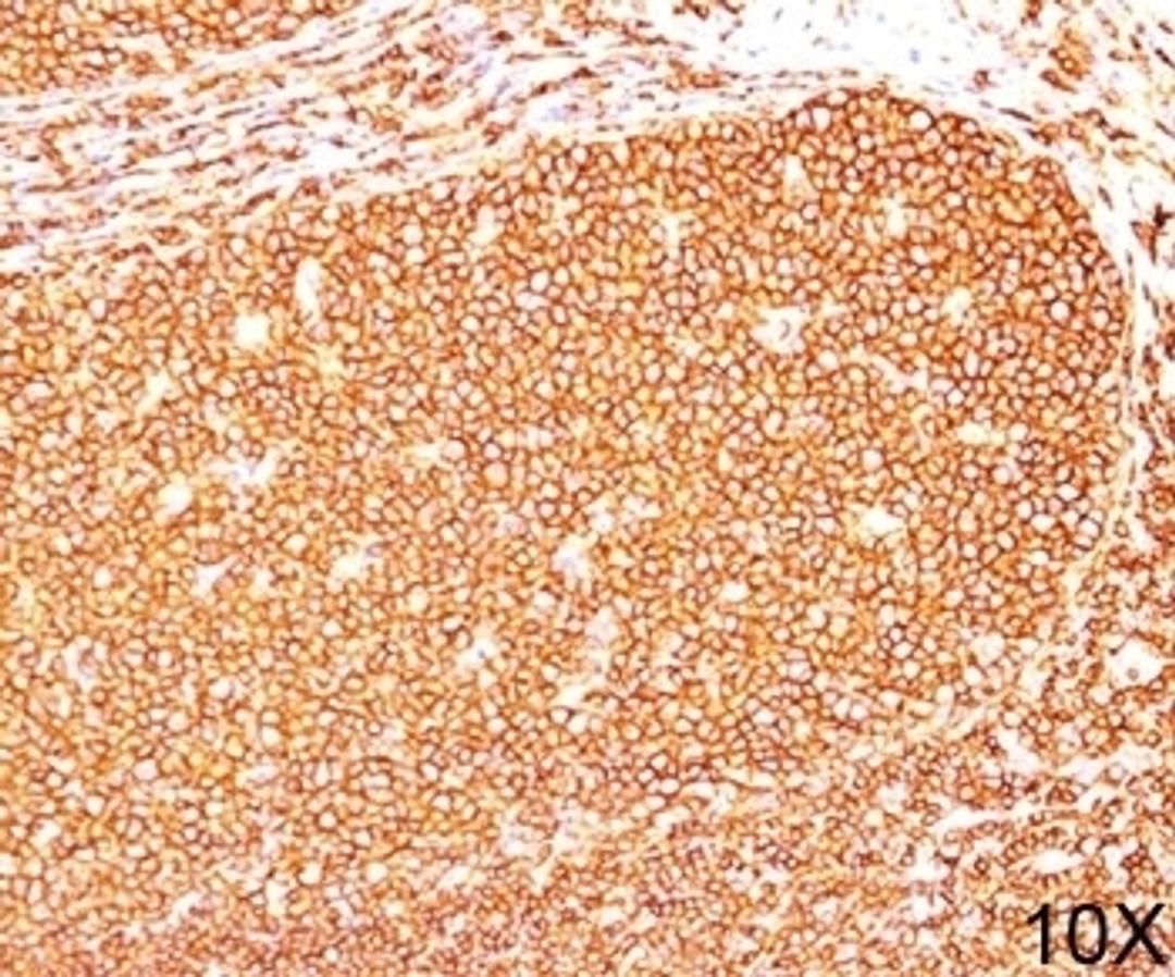 IHC testing of human tonsil (10X) stained with CD45RB antibody (PD7/26).