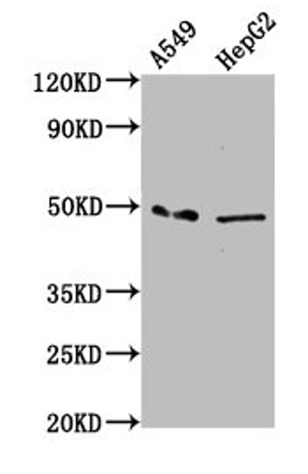 Western Blot. Positive WB detected in: A549 whole cell lysate, HepG2 whole cell lysate. All lanes: MFSD4A antibody at 3.38µg/ml. Secondary. Goat polyclonal to rabbit IgG at 1/50000 dilution. Predicted band size: 57, 47 kDa. Observed band size: 47 kDa