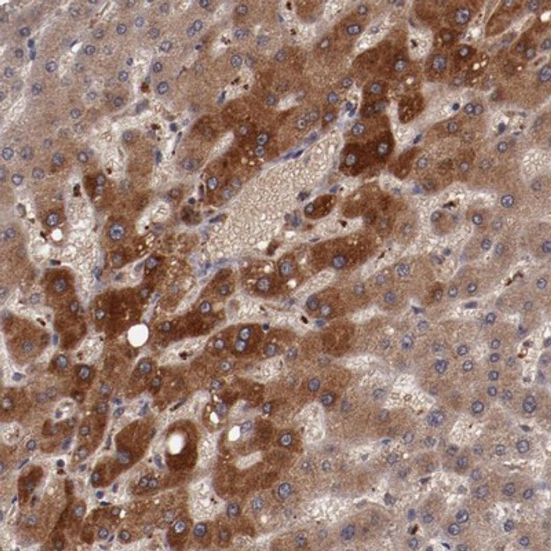 Immunohistochemistry-Paraffin: Ceruloplasmin Antibody [NBP1-88116] - Staining of human liver shows moderate cytoplasmic positivity in hepatocytes.